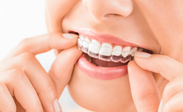 Expert Oral Surgery Services in West Covina: Your Guide to Better Oral Health